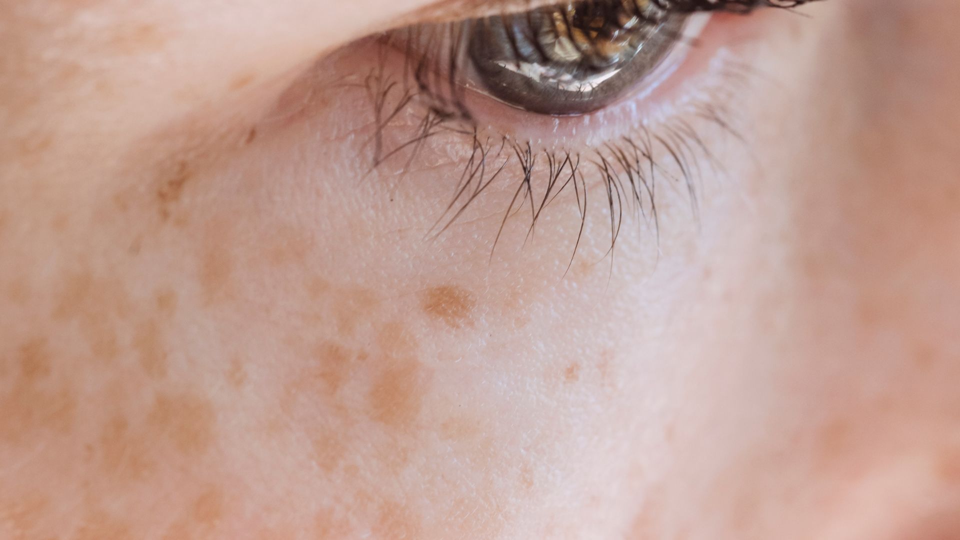 Woman with freckles looking away